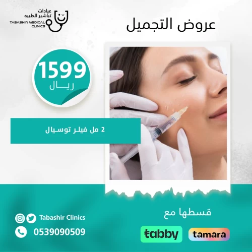 2 مل فيلر توسيال