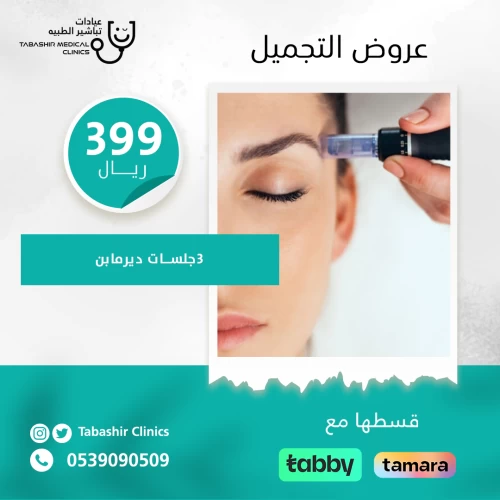 3 جلسات ديرمابن