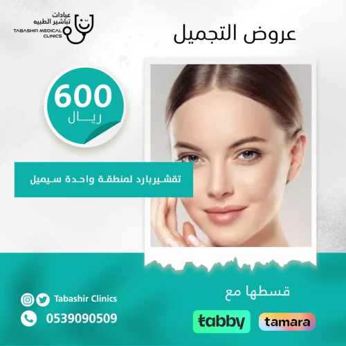 تقشير بارد لمنطقة واحدة سيميل
