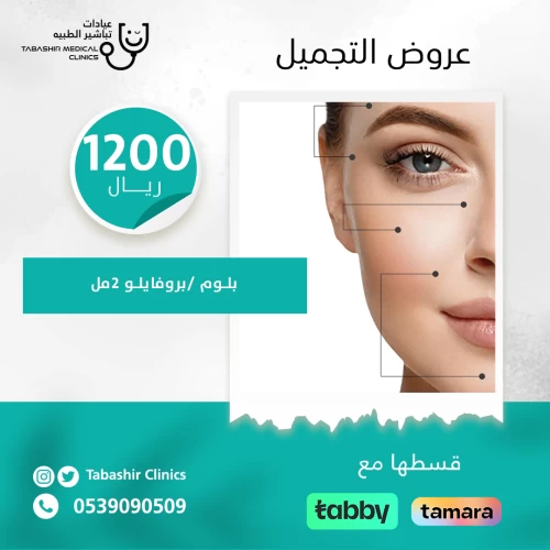 جلسة 2 مل بلوم/ بروفايلو