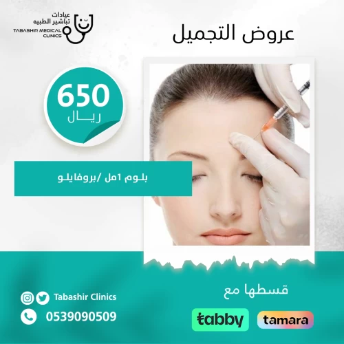 1مل بلوم/ بروفايلو