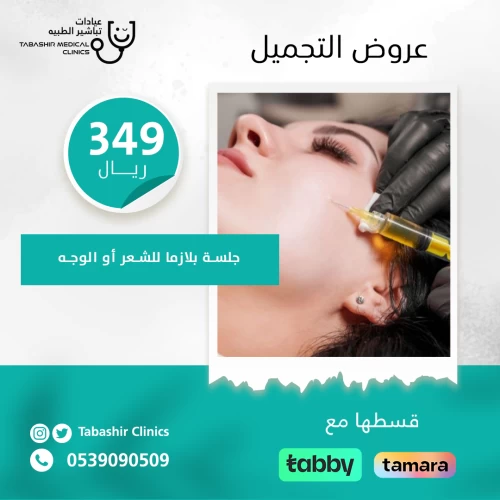 جلسة بلازما للشعر أو الوجه