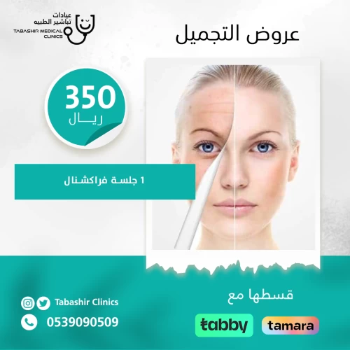 جلسة فراكشنال