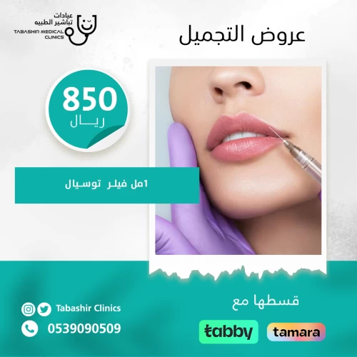 جلسة 1 مل فيلر توسيال