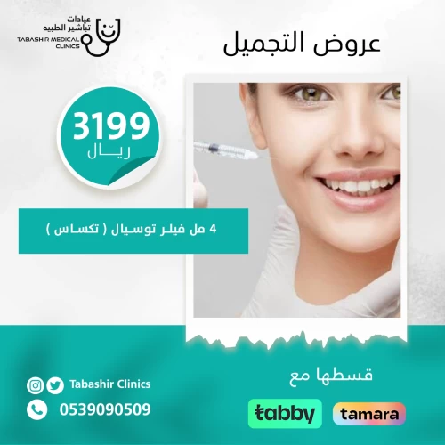 جلسة 4 مل فيلر توسيال