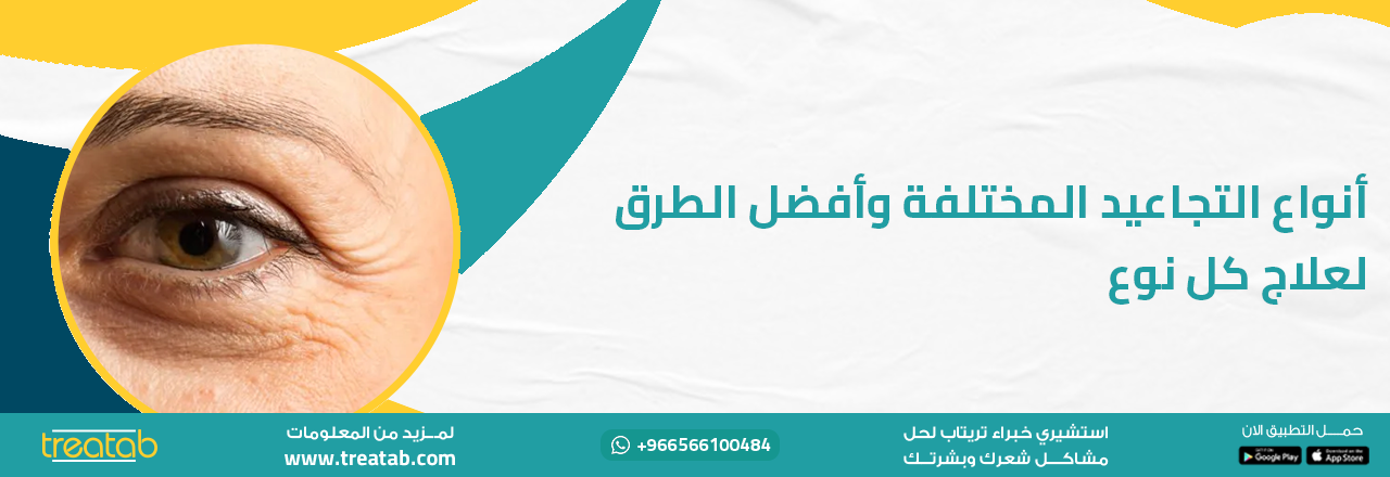 أنواع التجاعيد المختلفة وأفضل الطرق لعلاج كل نوع